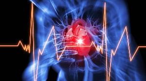 Инфаркт: алгоритм действий при болях в сердце Инфаркт 3.jpg